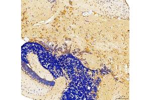 IHC analysis of Snai1b using anti-Snai1b antibody (ABIN7603728).
