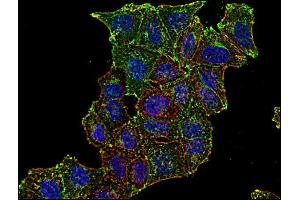 Immunofluorescence staining of CD71 in human HeLa cell line using anti-CD71 (; green). (Transferrin Receptor 抗体  (FITC))