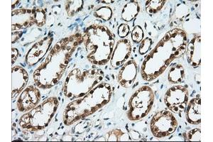 Immunohistochemical staining of paraffin-embedded Human thyroid tissue using anti-BDH2 mouse monoclonal antibody. (BDH2 抗体)