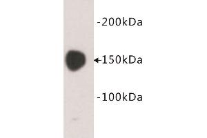 Western Blotting (WB) image for anti-Carcinoembryonic Antigen Gene Family (CEA) antibody (ABIN1854846)