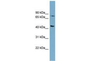 Image no. 1 for anti-Frizzled Family Receptor 6 (FZD6) (AA 539-588) antibody (ABIN6743054) (FZD6 抗体  (AA 539-588))