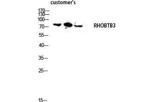 Western Blot (WB) analysis of lysis using RHOBTB3 antibody. (RHOBTB3 抗体  (Internal Region))