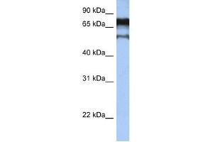 ZNF780B antibody used at 0. (ZNF780B 抗体  (N-Term))