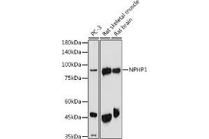 Western blot analysis of extracts of various cell lines, using NPHP1 antibody (ABIN6128349, ABIN6144768, ABIN6144769 and ABIN6222377) at 1:1000 dilution. (NPHP1 抗体  (AA 345-614))