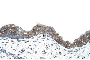 Human Skin (Erythrocyte Ankyrin 抗体  (C-Term))