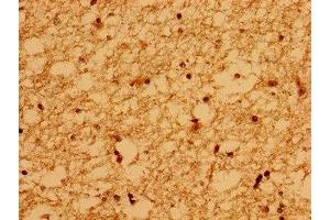 Immunohistochemistry of paraffin-embedded human brain tissue using ABIN7175718 at dilution of 1:100 (WDPCP 抗体  (AA 621-737))