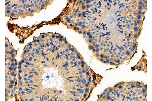 ABIN6259349 and ABIN6275564 at 1/100 staining Mouse testis tissue by IHC-P. (STAC2 抗体  (Internal Region))