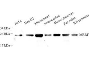 Western blot analysis of MRRF (ABIN7074657) at dilution of 1: 1000 (MRRF 抗体)