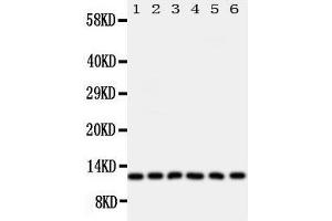 Anti-Glutaredoxin 2 antibody, Western blotting Lane 1: Rat Testis Tissue Lysate Lane 2: HELA Cell Lysate Lane 3: U87 Cell Lysate Lane 4: NEU Cell Lysate Lane 5: JURKAT Cell Lysate Lane 6: MCF-7 Cell Lysate (Glutaredoxin 2 抗体  (Middle Region))