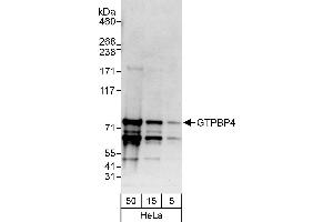 anti-GTP Binding Protein 4 (GTPBP4) (AA 200-250) antibody