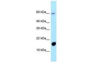 Image no. 1 for anti-Chromosome 5 Open Reading Frame 13 (C5orf13) (AA 13-62) antibody (ABIN6747935) (NREP 抗体  (AA 13-62))