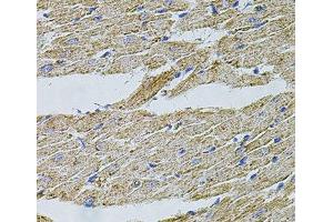 Immunohistochemistry (Paraffin-embedded Sections) (IHC (p)) image for anti-Transient Receptor Potential Cation Channel, Subfamily A, Member 1 (TRPA1) antibody (ABIN7264621)