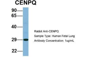 Host: Rabbit  Target Name: CENPQ  Sample Tissue: Human Fetal Lung  Antibody Dilution: 1. (CENPQ 抗体  (N-Term))