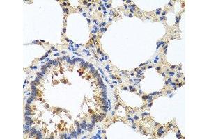 Immunohistochemistry of paraffin-embedded Rat lung using LRG1 Polyclonal Antibody at dilution of 1:100 (40x lens). (LRG1 抗体)