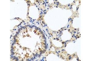 Immunohistochemistry of paraffin-embedded Rat lung using LRG1 Polyclonal Antibody at dilution of 1:100 (40x lens).