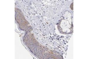Immunohistochemical staining of human skin with PPFIBP1 polyclonal antibody  shows moderate cytoplasmic positivity in epidermal cells and adnexal cells at 1:200-1:500 dilution. (PPFIBP1 抗体)