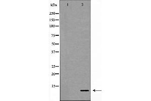 Western blot analysis of lovo cell lysate, using S100A11 Antibody. (S100A11 抗体  (Internal Region))