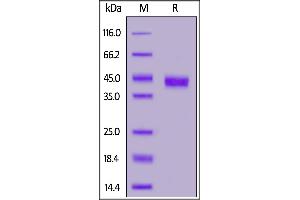 Human CD32b/c, SUMO,His Tag on  under reducing (R) condition. (FCGR2B Protein (AA 46-217) (His tag,SUMO Tag))