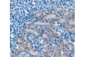 Immunohistochemistry (IHC) image for anti-Galectin 3 (LGALS3) (AA 2-264) antibody (ABIN1078056)