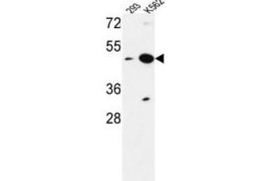 Western Blotting (WB) image for anti-Nucleoporin Like 2 (NUPL2) antibody (ABIN3004233) (NUPL2 抗体)