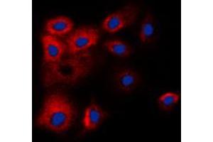 Immunofluorescent analysis of BCLW staining in HL60 cells. (BCL2L2 抗体  (C-Term))