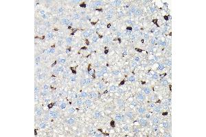 Immunohistochemistry (IHC) image for anti-Coronin, Actin Binding Protein, 1A (CORO1A) (AA 362-461) antibody (ABIN6138903)