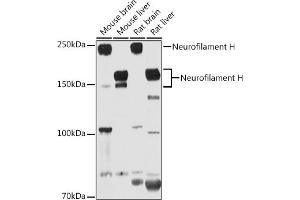 Western blot analysis of extracts of various cell lines, using Neurofilament H antibody (ABIN6129638, ABIN6144512, ABIN6144513 and ABIN6224502) at 1:1000 dilution. (NEFH 抗体  (AA 821-1020))