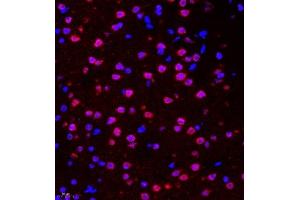 Immunofluorescence of paraffin embedded mouse brain using HES3 (ABIN7074159) at dilution of 1:2000 (400x lens) (HES3 抗体)