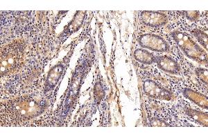 Detection of UCRP in Porcine Small intestine Tissue using Polyclonal Antibody to Ubiquitin Cross Reactive Protein (UCRP) (CLRN1 Antisense RNA 1 (CLRN1-AS1) (AA 2-157) 抗体)