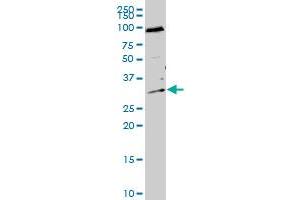 HTATIP2 polyclonal antibody (A01), Lot # 050921JC01. (HIV-1 Tat Interactive Protein 2, 30kDa (HTATIP2) (AA 1-242) 抗体)