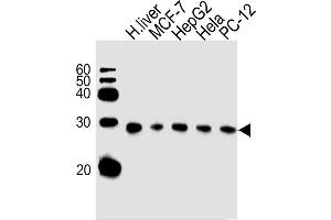 Lane 1: Human Liver Lysates, Lane 2: MCF-7 Cell Lysates, Lane 3: HepG2 Cell Lysates, Lane 4: HeLa Cell Lysates, Lane 5: PC-12 Cell Lysates, probed with PSMA5 (426CT8. (PSMA5 抗体)