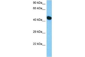Host:  Mouse  Target Name:  HNF1B  Sample Tissue:  Mouse Skeletal Muscle  Antibody Dilution:  1ug/ml (HNF1B 抗体  (C-Term))