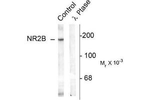 Image no. 1 for anti-Glutamate Receptor, Ionotropic, N-Methyl D-Aspartate 2B (GRIN2B) (pTyr1336) antibody (ABIN372686) (GRIN2B 抗体  (pTyr1336))