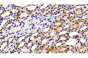 Detection of Kim1 in Rat Kidney Tissue using Polyclonal Antibody to Kidney Injury Molecule 1 (Kim1) (HAVCR1 抗体  (AA 22-235))