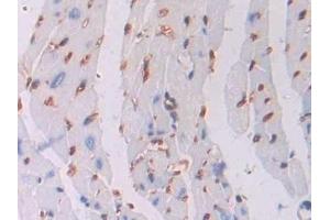 Detection of OSM in Mouse Heart Tissue using Polyclonal Antibody to Oncostatin M (OSM)