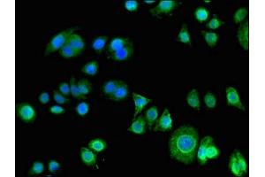 Immunofluorescent analysis of PC-3 cells using ABIN7163671 at dilution of 1:100 and Alexa Fluor 488-congugated AffiniPure Goat Anti-Rabbit IgG(H+L) (PHLDA3 抗体  (AA 43-95))