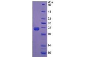 SDS-PAGE of Protein Standard from the Kit (Highly purified E. (Calreticulin ELISA 试剂盒)