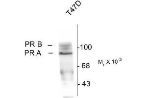Western Blotting (WB) image for anti-Progesterone Receptor (PGR) (pSer190) antibody (ABIN371834) (Progesterone Receptor 抗体  (pSer190))