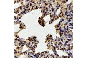 Immunohistochemistry (IHC) image for anti-Ran GTPase Activating Protein 1 (RANGAP1) antibody (ABIN7308258) (RANGAP1 抗体)
