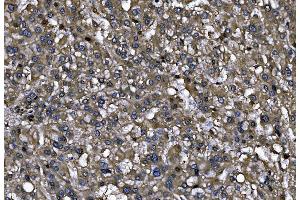 IHC analysis of ENAH/MENA using anti-ENAH/MENA antibody (ABIN7601316).