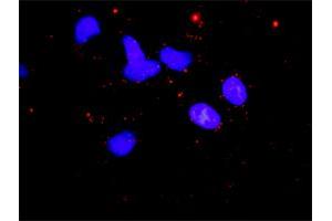 Proximity Ligation Analysis of protein-protein interactions between STK11 and CAB39. (CAB39 抗体  (AA 1-341))