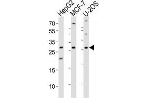 Western Blotting (WB) image for anti-Inhibitor of DNA Binding 1, Dominant Negative Helix-Loop-Helix Protein (ID1) (AA 66-93) antibody (ABIN3031300)