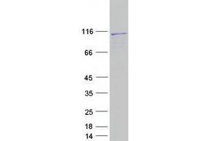 Validation with Western Blot