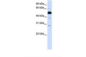 Image no. 1 for anti-Family with Sequence Similarity 134, Member B (FAM134B) (AA 254-303) antibody (ABIN6738133) (FAM134B 抗体  (AA 254-303))