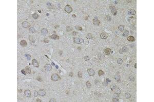 Immunohistochemistry of paraffin-embedded Mouse brain using CKAP4 Polyclonal Antibody (CKAP4 抗体)
