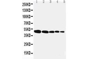 Anti-Flotillin 1 antibody, Western blotting Lane 1: Rat Lung Tissue Lysate Lane 2: Rat Brain Tissue Lysate Lane 3: Rat Ovary Tissue Lysate Lane 4: SMMC Cell Lysate Lane 5: MFC-7 Cell Lysate