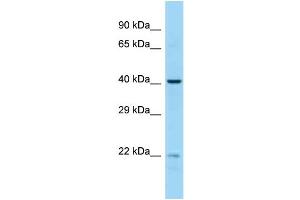 Host:  Rabbit  Target Name:  EME2  Sample Type:  MCF7 Whole cell lysates  Antibody Dilution:  1. (EME2 抗体  (Middle Region))
