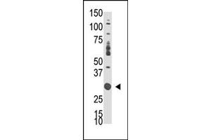 Western Blotting (WB) image for anti-Docking Protein 5 (DOK5) (C-Term) antibody (ABIN359963) (DOK5 抗体  (C-Term))