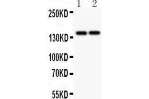 Anti-Collagen III Picoband antibody,  All lanes: Anti Collagen III at 0. (COL3A1 抗体  (C-Term))