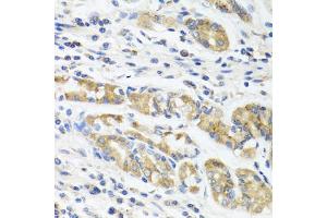 Immunohistochemistry of paraffin-embedded human stomach using IL11 antibody (ABIN5975342) at dilution of 1/100 (40x lens). (IL-11 抗体)